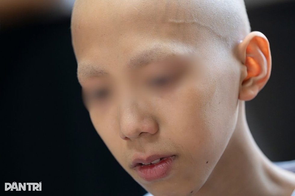 Kiệt quệ vì chữa ung thư, cậu bé vẫn ôm ước mơ được quay lại trường học - 5