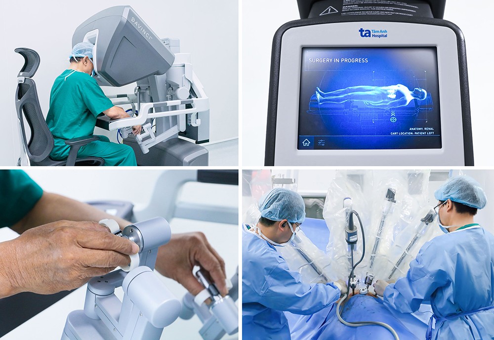 Robot phẫu thuật thế hệ mới “cập bến” Bệnh viện Tâm Anh: Người bệnh tiết kiệm tới cả tỷ đồng mỗi ca 7 Bệnh viện Đa khoa Tâm Anh ứng dụng thành công “siêu Robot” Da Vinci Xi hỗ trợ hơn 120 loại phẫu thuật. Ảnh: Bệnh viện Đa khoa Tâm Anh