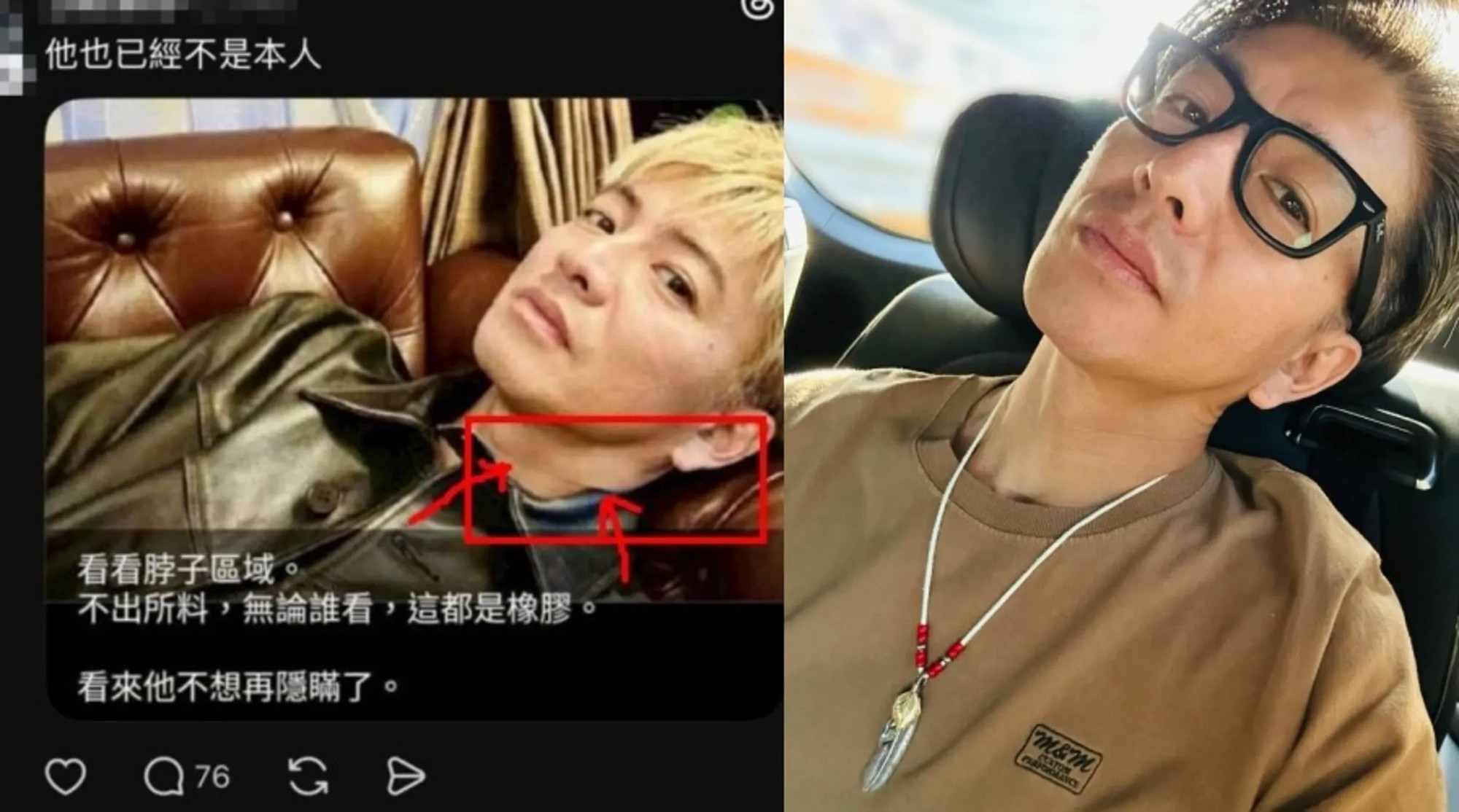 Chuyện khó tin về nam thần số một Nhật Bản- Ảnh 5. Chuyện khó tin về nam thần số một Nhật Bản- Ảnh 5.