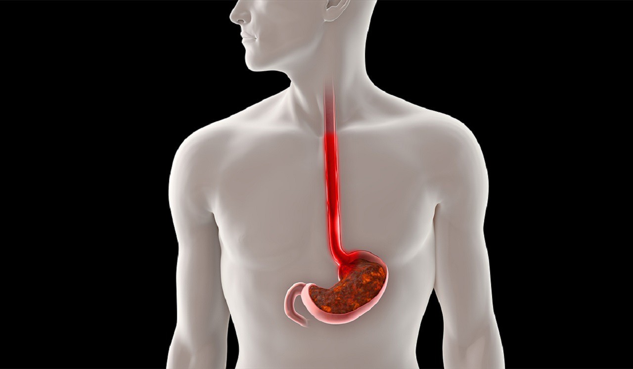 Những món người Việt yêu thích không ngờ làm tăng nguy cơ mắc ung thư thực quản 4 Những món người Việt yêu thích không ngờ làm tăng nguy cơ mắc ung thư thực quản - 3