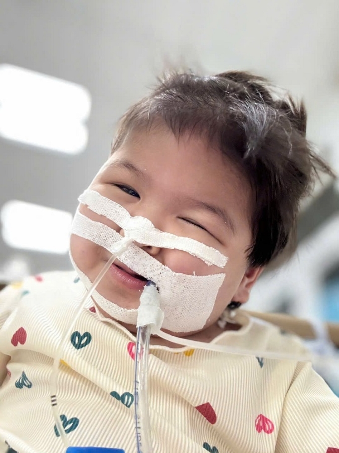 Bé Linh vui cười lúc khỏe. Ảnh: Kim Ny