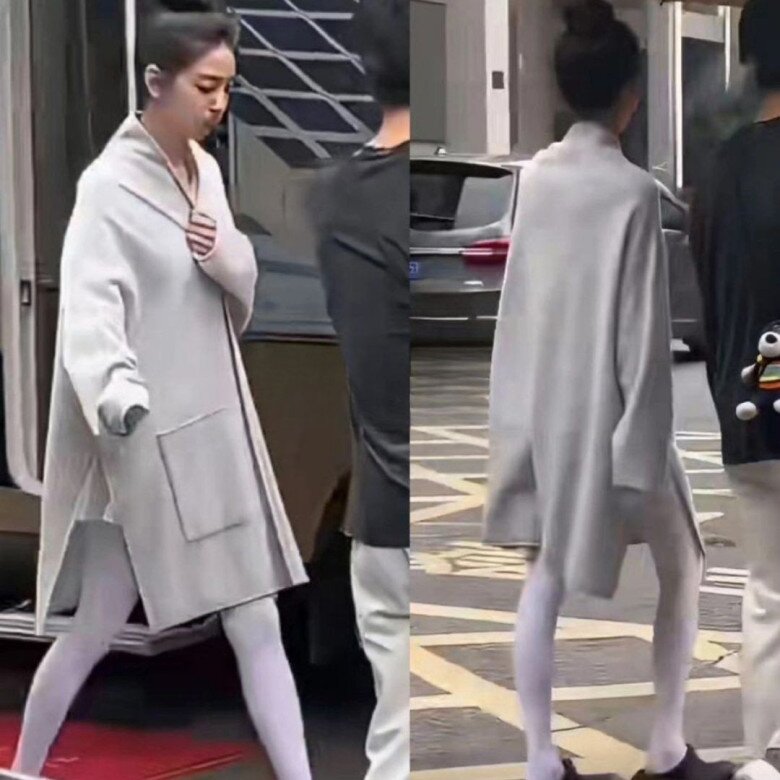 Nữ diễn viên là "người tình trong mộng" của showbiz: Nhan sắc hút 70 triệu lượt xem, nay chân "teo tóp" nhìn mà sợ 2 Đôi chân tong teo, không thấy chút da thịt nào còn được cư dân mạng xứ Trung so sánh với “hai sào tre”.