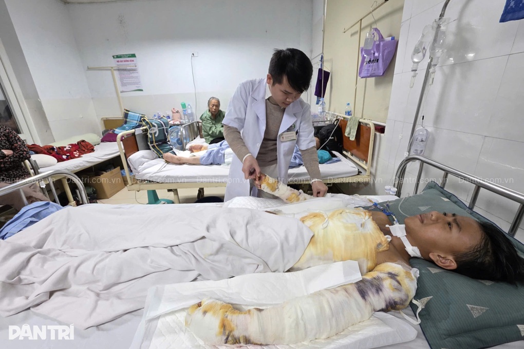 Nam sinh 14 tuổi nguy cơ phải cắt bỏ cả hai tay sau cú điện giật kinh hoàng - 2
