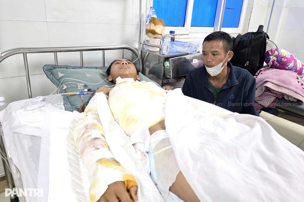 Nam sinh 14 tuổi nguy cơ phải cắt bỏ cả hai tay sau cú điện giật kinh hoàng - 3