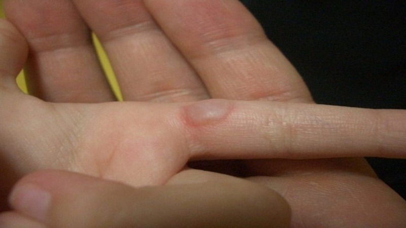 Cả đời dùng ấm siêu tốc, ai cũng nghĩ nó vô hại: Nào ngờ tiềm ẩn 4 rủi ro đe dọa sức khỏe- Ảnh 3. Cả đời dùng ấm siêu tốc, ai cũng nghĩ nó vô hại: Nào ngờ tiềm ẩn 4 rủi ro đe dọa sức khỏe- Ảnh 3.