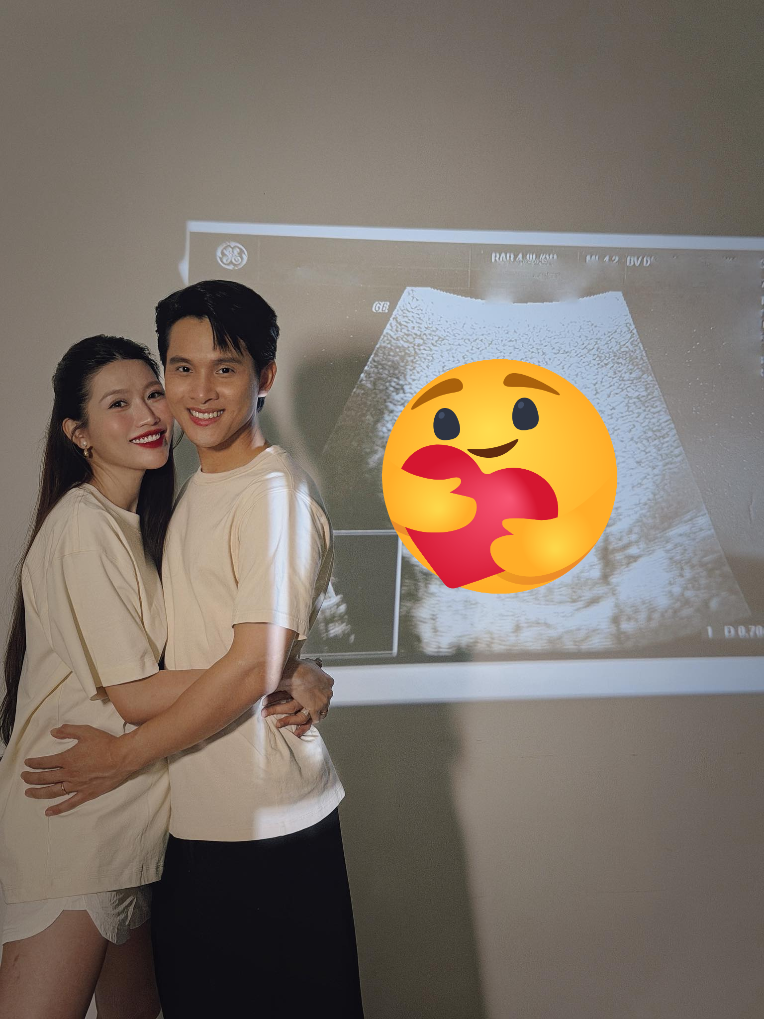 1765260821 591 Che Nguyen Quynh Chau mang thai con dau long sau