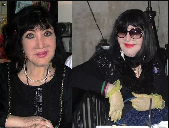 Dung nhan 2 bóng hồng nổi tiếng trong đời Thương Tín: "Nữ hoàng ảnh lịch" U65 vẫn đẹp sang, tuyệt đỉnh giai nhân lại tàn tạ 10 Nhan sắc bị biến dạng của đại mỹ nhân một thời khiến bao người tiếc nuối.