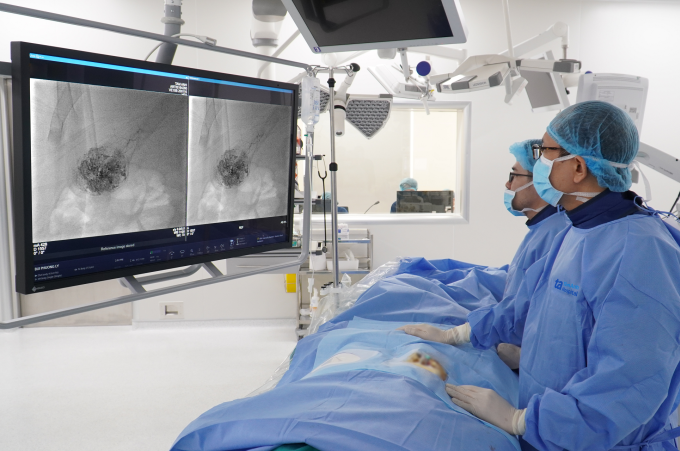 Êkíp nút mạch khối u gan cho ông Phong. Ảnh: Bệnh viện Đa khoa Tâm Anh