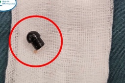 Bé 7 tuổi tử vong do hóc đầu bút bi trong lớp học