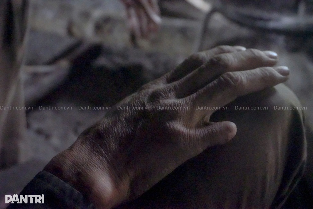 Người đàn ông bị khối u hành hạ và nỗi lo dắt bà lão chạy trốn gió mưa - 2