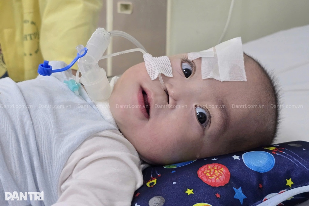 Bé trai sinh non 24 tuần thai, 14 tháng tuổi vẫn chưa thể tự thở - 3