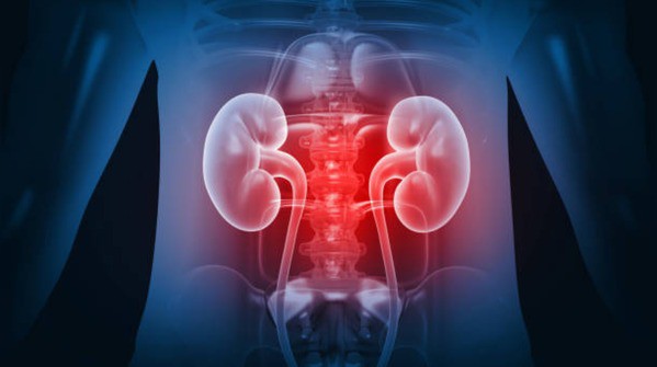 Những loại thực phẩm rất tốt nhưng ăn nhiều lại hủy hoại thận 4 Những loại thực phẩm rất tốt nhưng ăn nhiều lại hủy hoại thận - 3