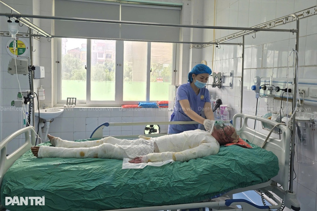 Gia cảnh kiệt quệ của người bố đơn thân bị bỏng khí gas mong được sống - 2