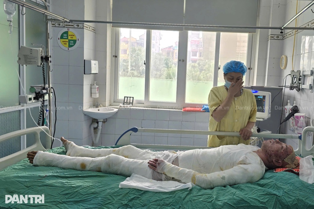 Gia cảnh kiệt quệ của người bố đơn thân bị bỏng khí gas mong được sống - 3