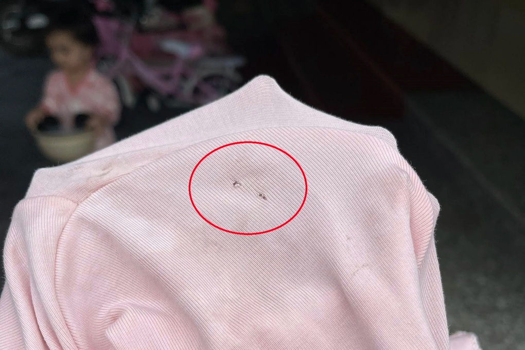 Vụ bé gái bị cắn, cô trả lời bao nhiêu là việc: Vì sao camera tê liệt? - 3