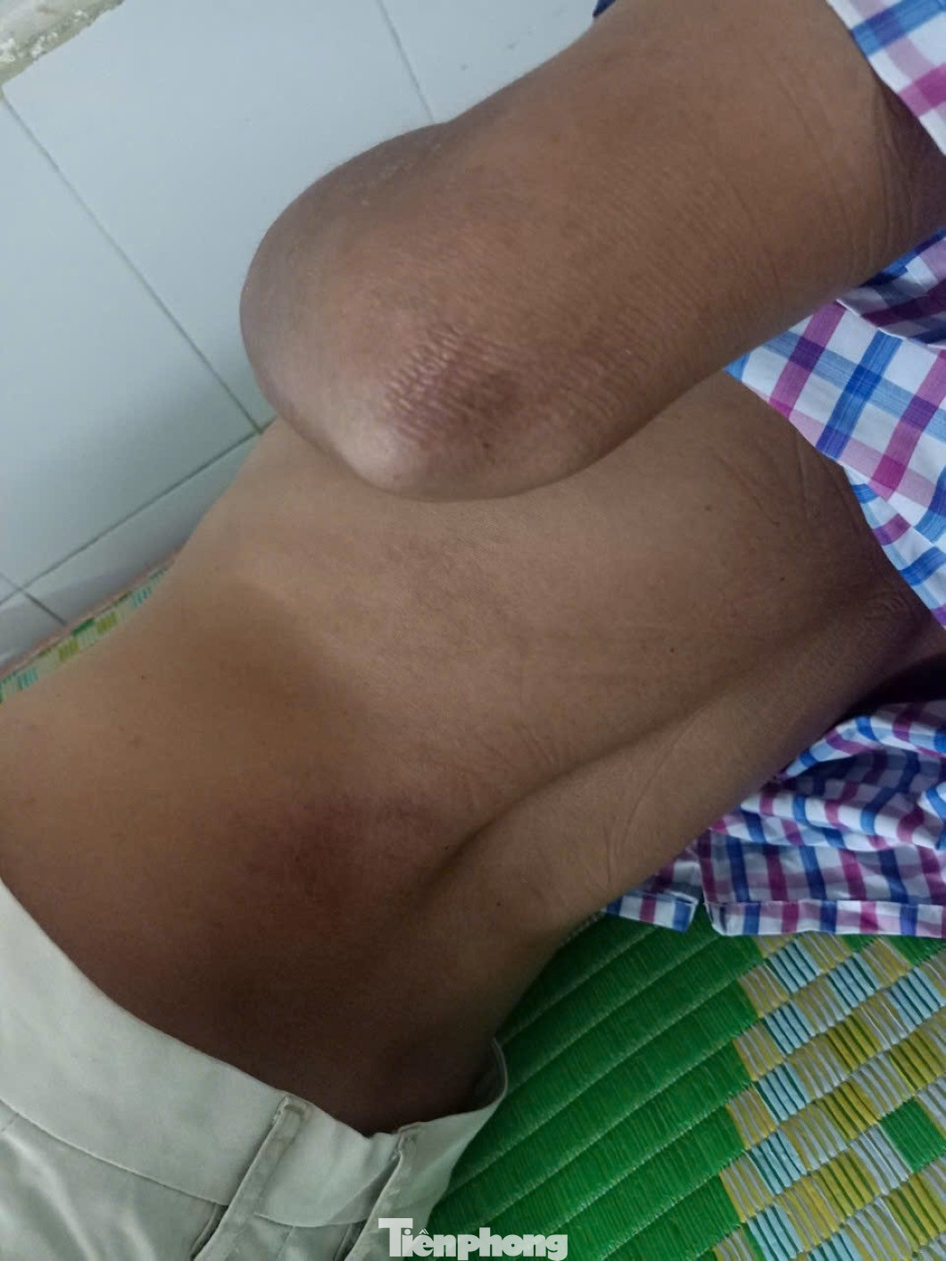 Vụ bị đánh đến ‘thân tàn ma dại’, thương tích 0%': Dấu hỏi nguyên nhân khiến nạn nhân yếu liệt tứ chi?- Ảnh 2.