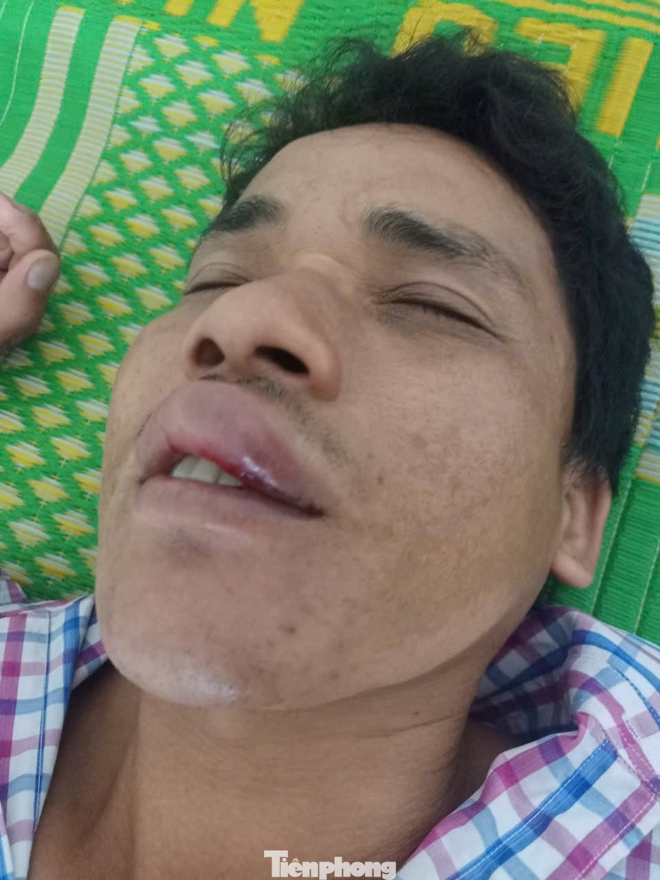 Vụ bị đánh đến ‘thân tàn ma dại’, thương tích 0%': Dấu hỏi nguyên nhân khiến nạn nhân yếu liệt tứ chi?- Ảnh 3.