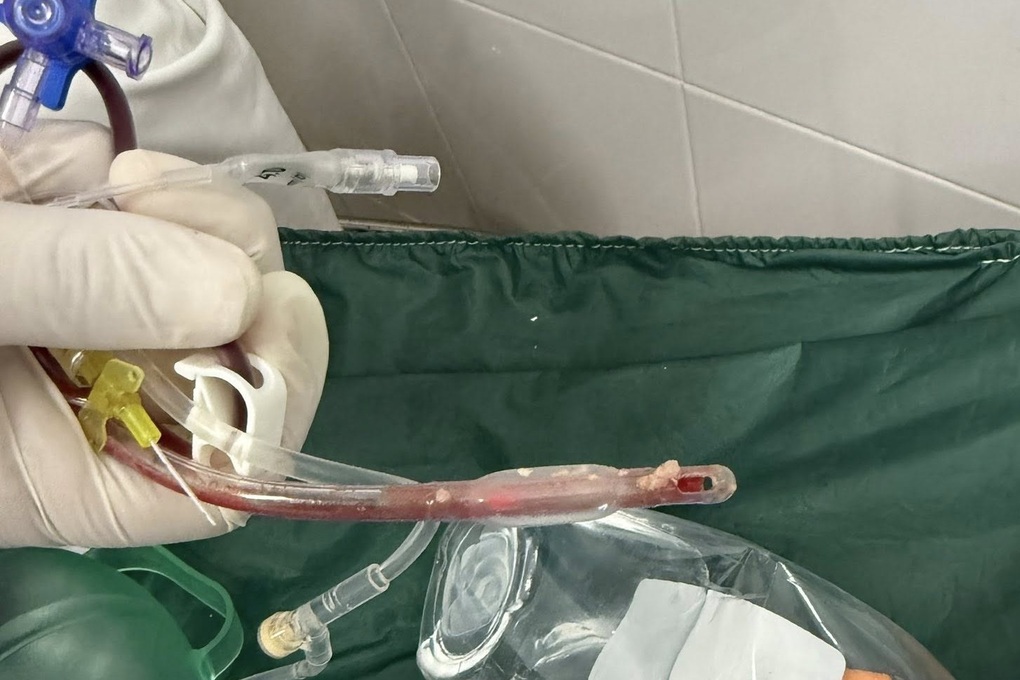 Bé gái 3 tuổi tử vong sau bữa ăn tại nhà trẻ: 70 phút cấp cứu bất thành - 2 Bé gái 3 tuổi tử vong sau bữa ăn tại nhà trẻ: 70 phút cấp cứu bất thành - 2