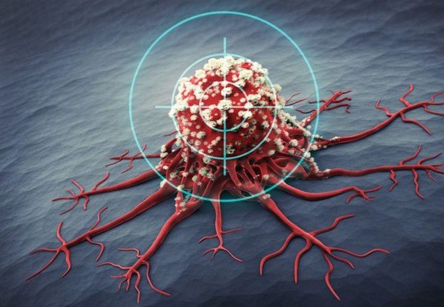 Tế bào ung thư sợ gì nhất?: Phát hiện nhiều điểm yếu để loại bỏ tế bào ung thư 3 Ảnh minh họa.