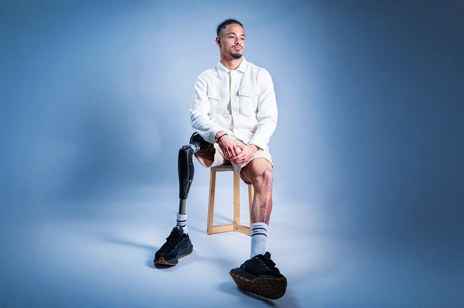 Ngỡ chỉ cảm cúm, cầu thủ Pháp phải cắt một chân do não mô cầu 1 VNVC - Ảnh 2.