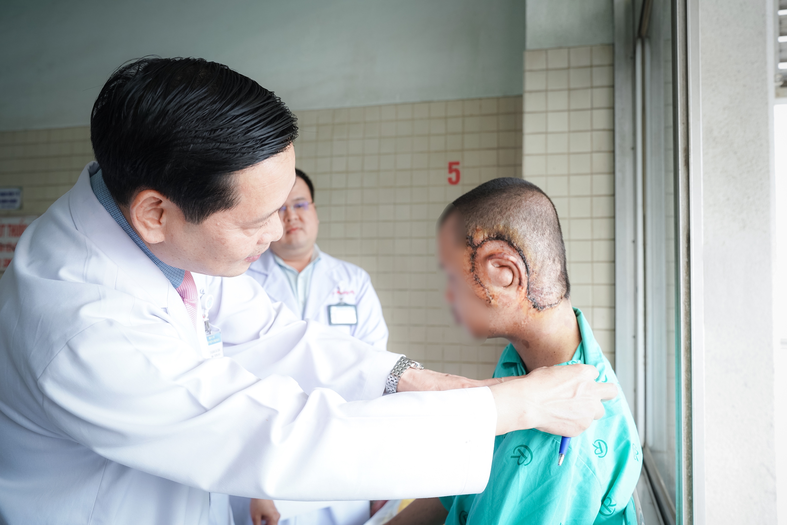 Bệnh viện Chợ Rẫy 'trả lại' gương mặt cho bệnh nhân bị u khủng làm biến dạng- Ảnh 3.
