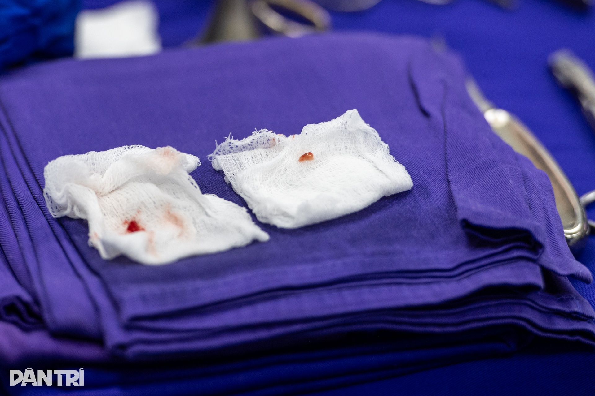 Hồi hộp xem bác sĩ cấy tai máy mang thanh âm cho em bé khiếm thính - 10