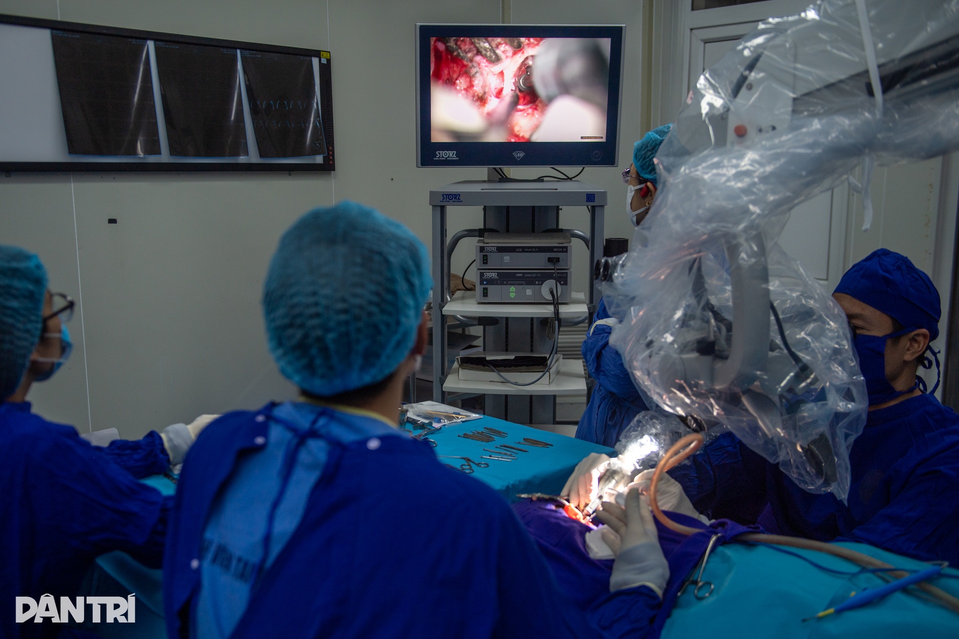 Hồi hộp xem bác sĩ cấy tai máy mang thanh âm cho em bé khiếm thính - 11