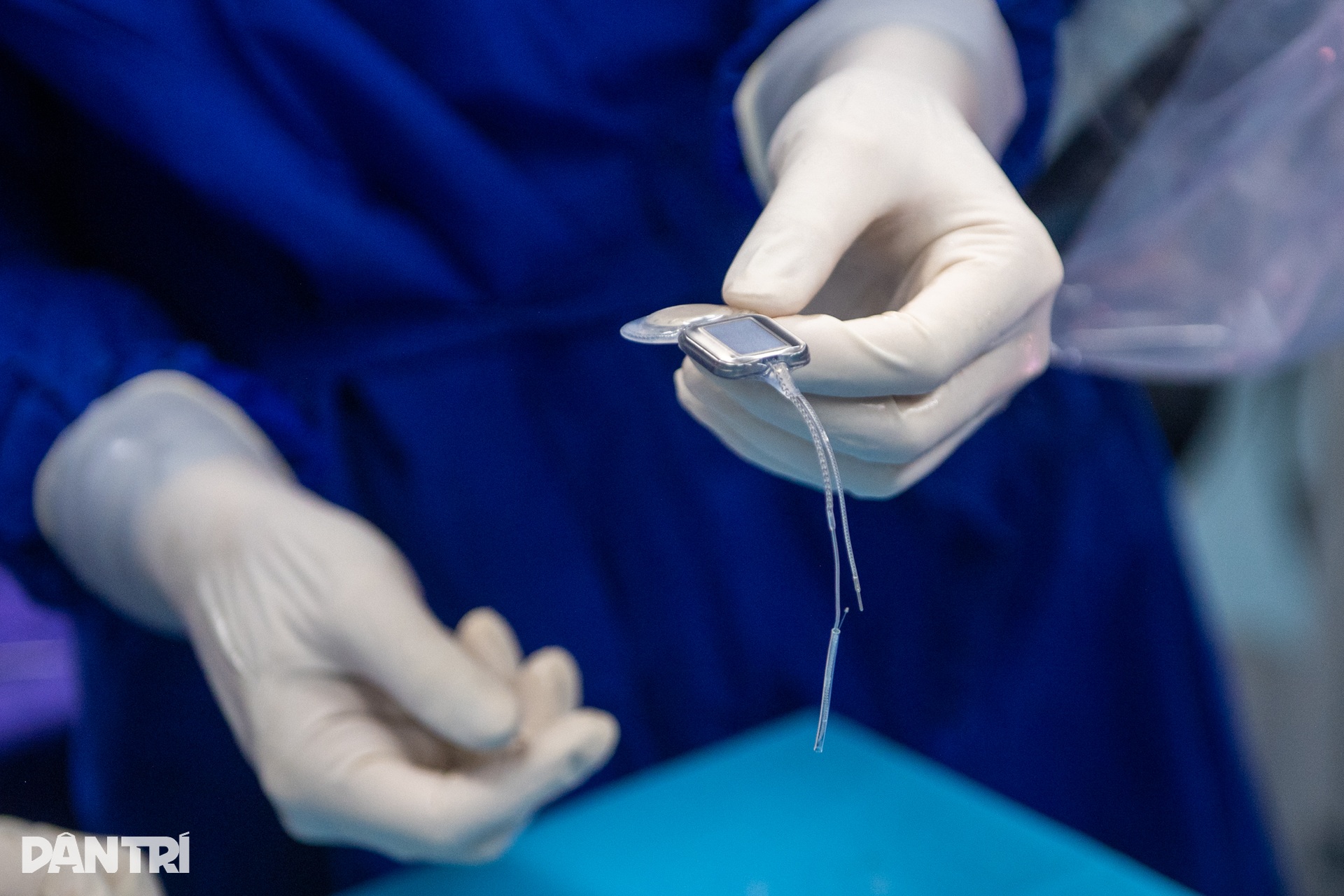 Hồi hộp xem bác sĩ cấy tai máy mang thanh âm cho em bé khiếm thính - 15