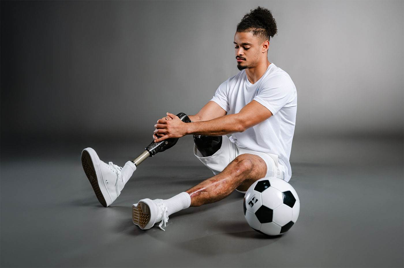 Nỗi đau người mẹ khi con trai cầu thủ cắt bỏ chân vì bệnh não mô cầu 2 Nỗi đau người mẹ khi con trai cầu thủ cắt bỏ chân vì bệnh não mô cầu - Ảnh 2.