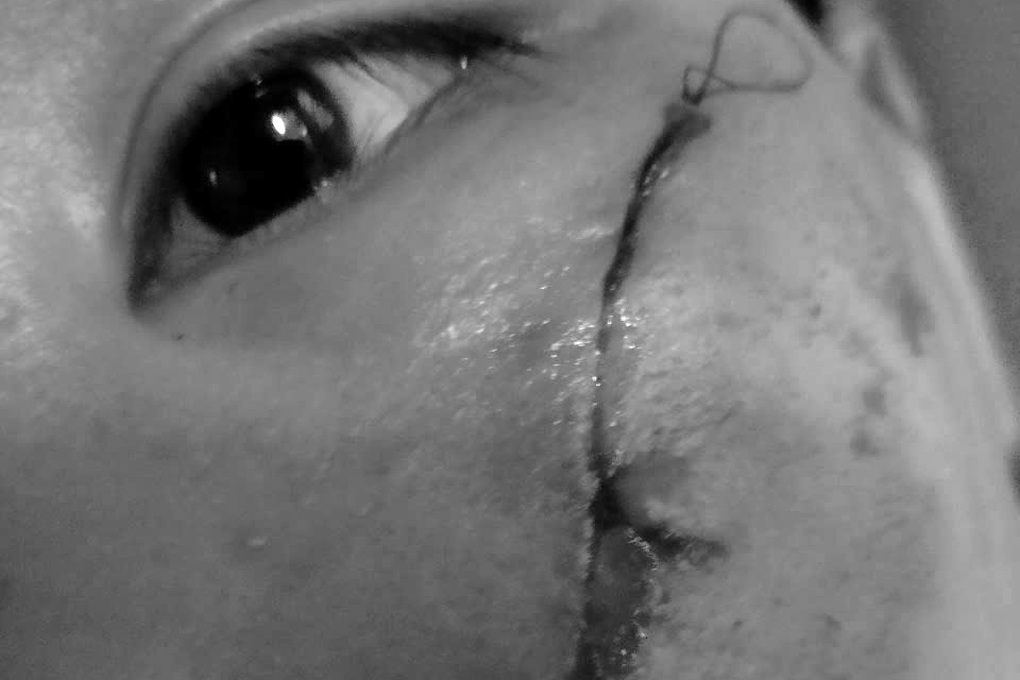 Sở Y tế TPHCM cảm ơn phóng viên Dân trí trong vụ việc ở mái ấm Thiên Thần - 3