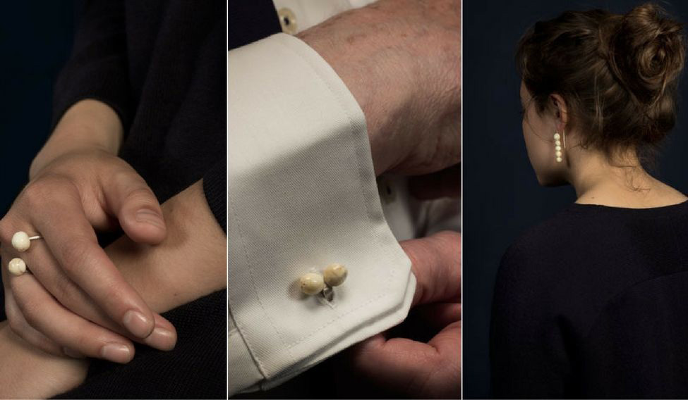 Cô gái chuyên thu mua răng người- Ảnh 2.