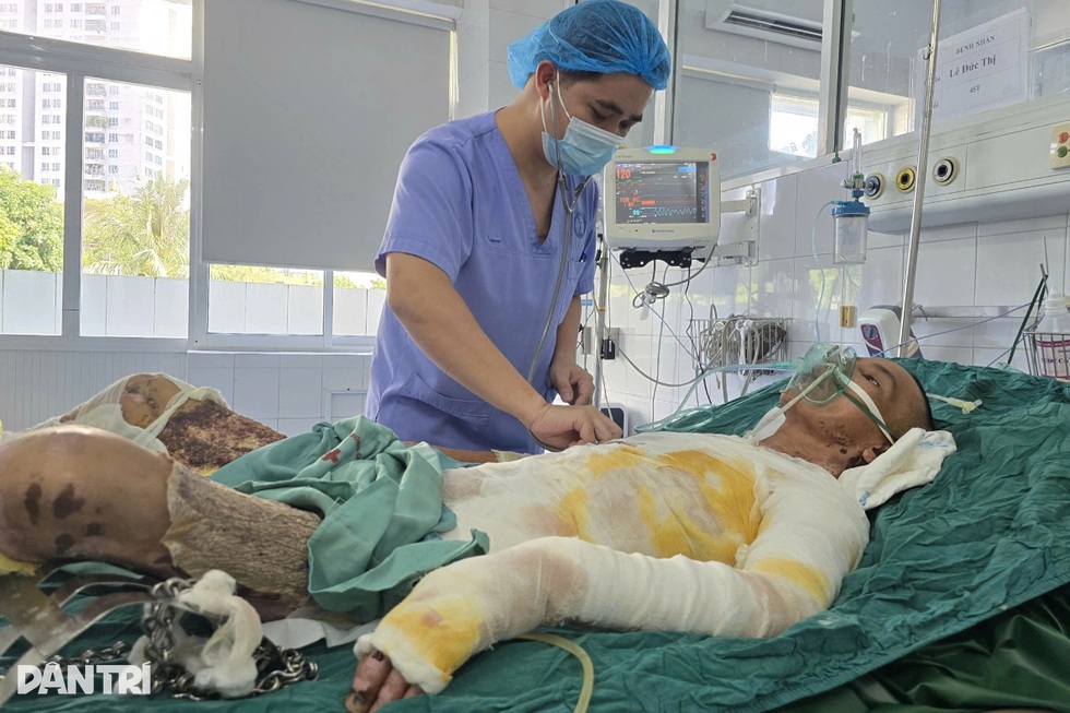 Thoát cửa tử sau tai nạn bỏng, người bố nghèo tập đi những bước đầu tiên - 3