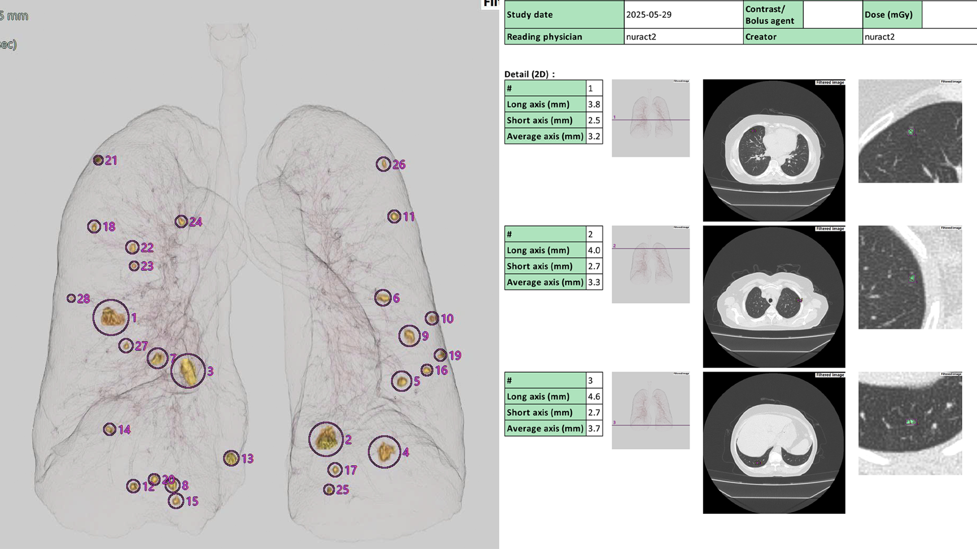 Chỉ chậm 2 tháng, ung thư đã hình thành: Tầm soát sớm và định kỳ thế nào?- Ảnh 3.