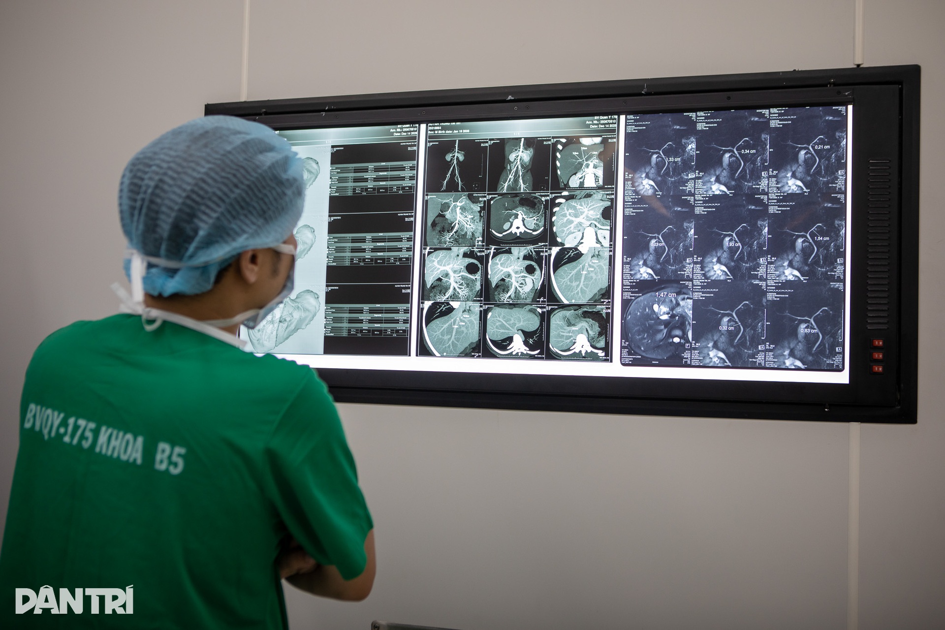 Xuyên đêm ghép gan, bác sĩ quân y giành lại sự sống cho bệnh nhân - 9