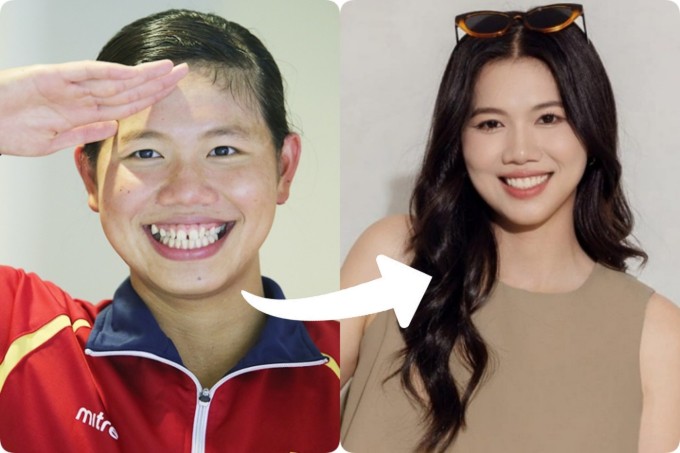 Kình ngư Ánh Viên 'thăng hạng' nhan sắc nhờ niềng răng, dán sứ.