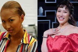 Sao Việt 'lột xác' ngoạn mục sau phẫu thuật thẩm mỹ