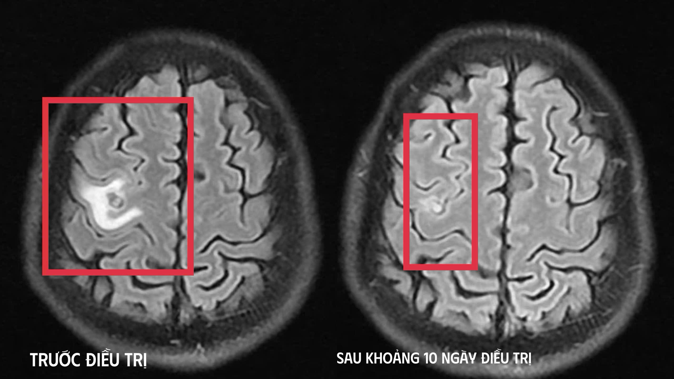 sán dây chó - Ảnh 2.