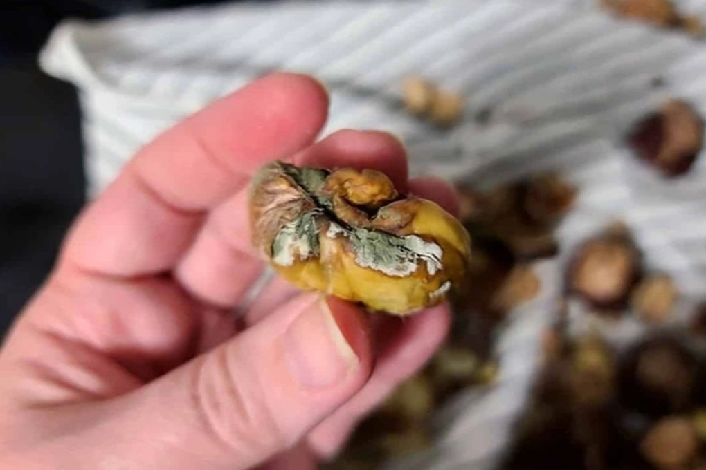 Trung Quốc: Cô gái 27 tuổi bị ung thư dạ dày vì 3 món hay trữ trong tủ lạnh - 2