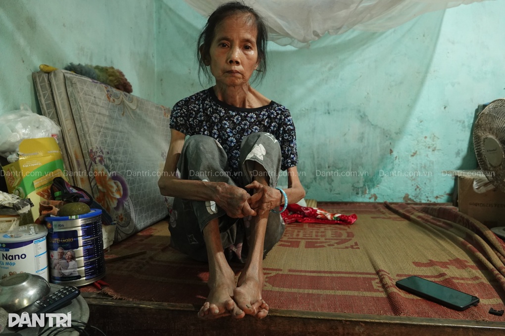 Người phụ nữ khuyết tật sống cô độc mong vòng tay nhân ái sẻ chia - 2