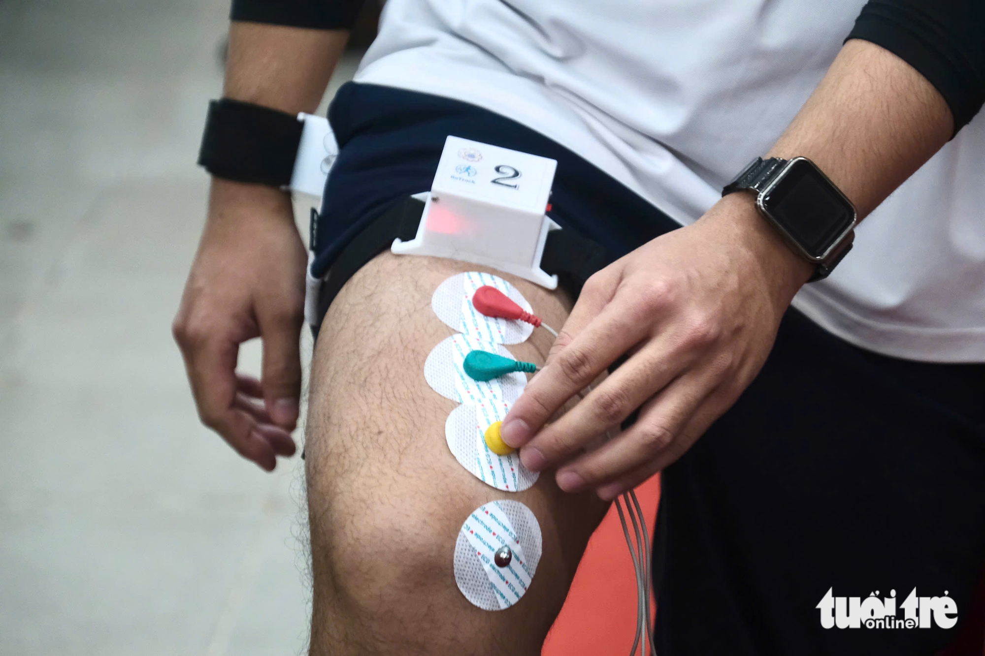 đột quỵ - Ảnh 2.