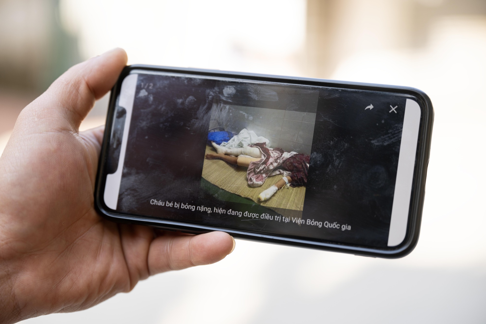 Vụ thả chó dữ cắn người phụ nữ ở Hà Nội: Nhân chứng kể lại phút kinh hoàng và quá khứ 