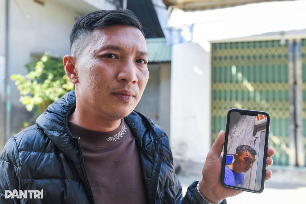 Đối tượng điều chó cắn người từng đá chảo mỡ khiến 2 cháu bé bị bỏng nặng - 3