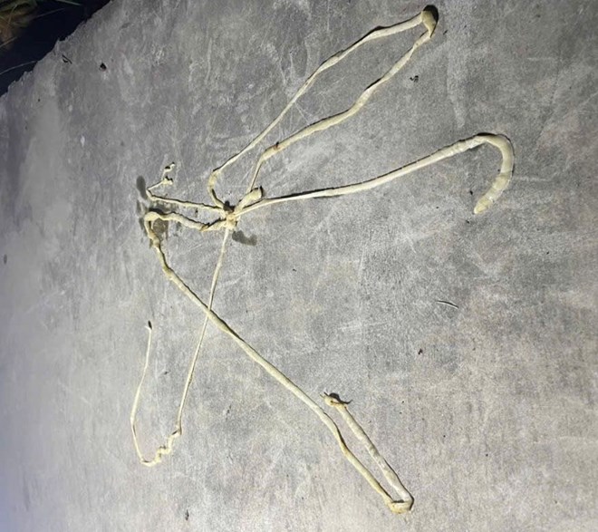 sán lợn - Ảnh 2.