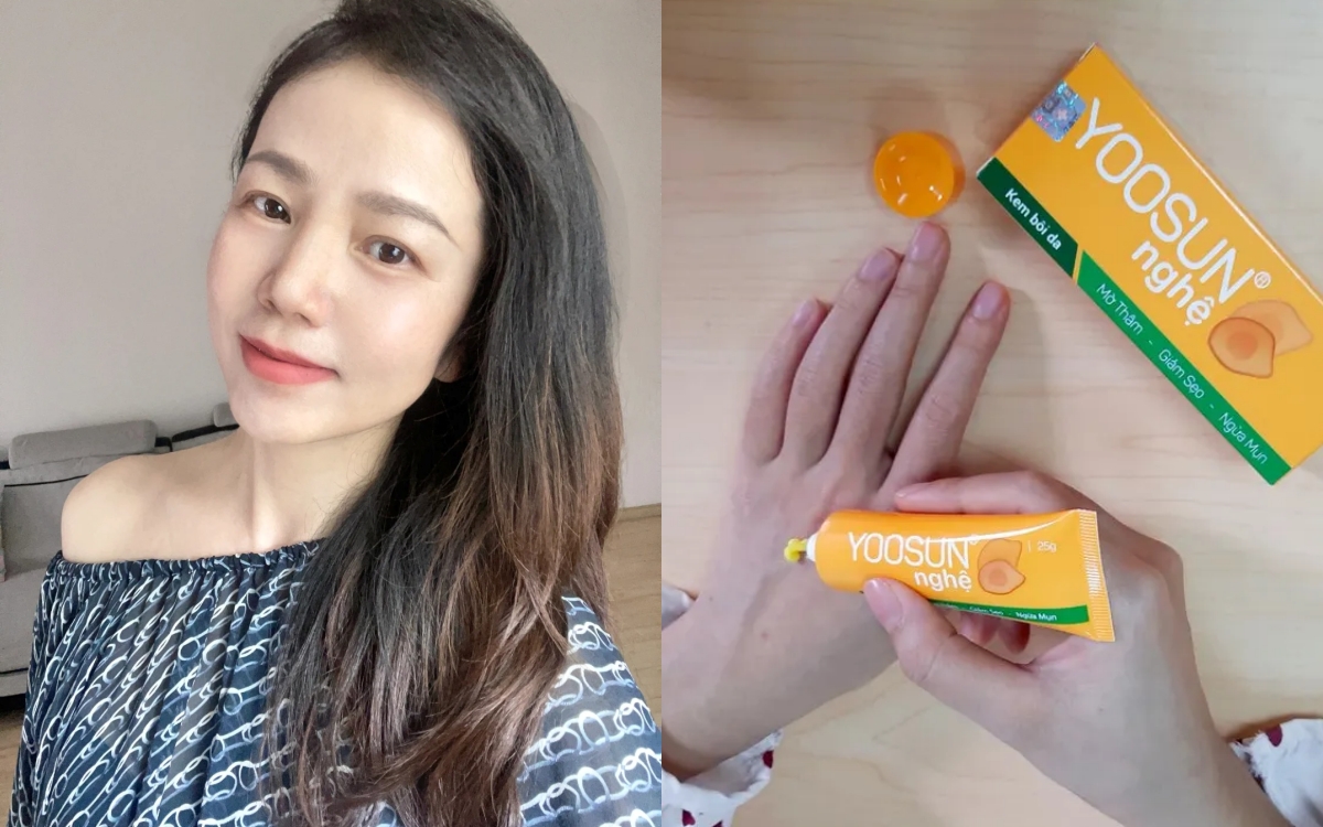 5 món mỹ phẩm nghệ 