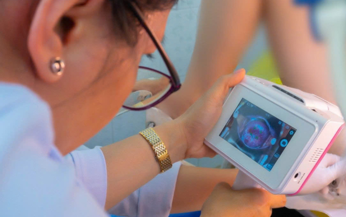 Bác sĩ Bệnh viện Hùng Vương ứng dụng kỹ thuật Cervicare AI tầm soát ung thư cổ tử cung. Ảnh: Yến Phạm