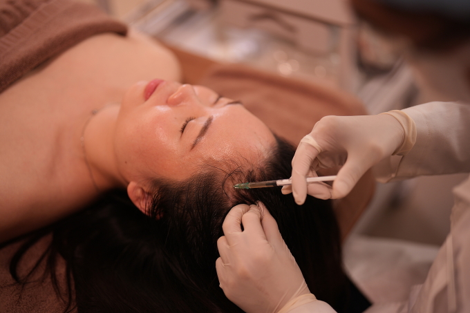 Bác sĩ đang thực hiện tiêm meso điều trị rụng tóc cho một phụ nữ. Ảnh: Bệnh viện Đa khoa Tâm Anh