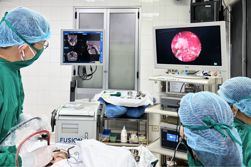 Bác sĩ tiết lộ nguyên nhân 269 ca mổ nội soi mũi xoang ở TPHCM thất bại - 1