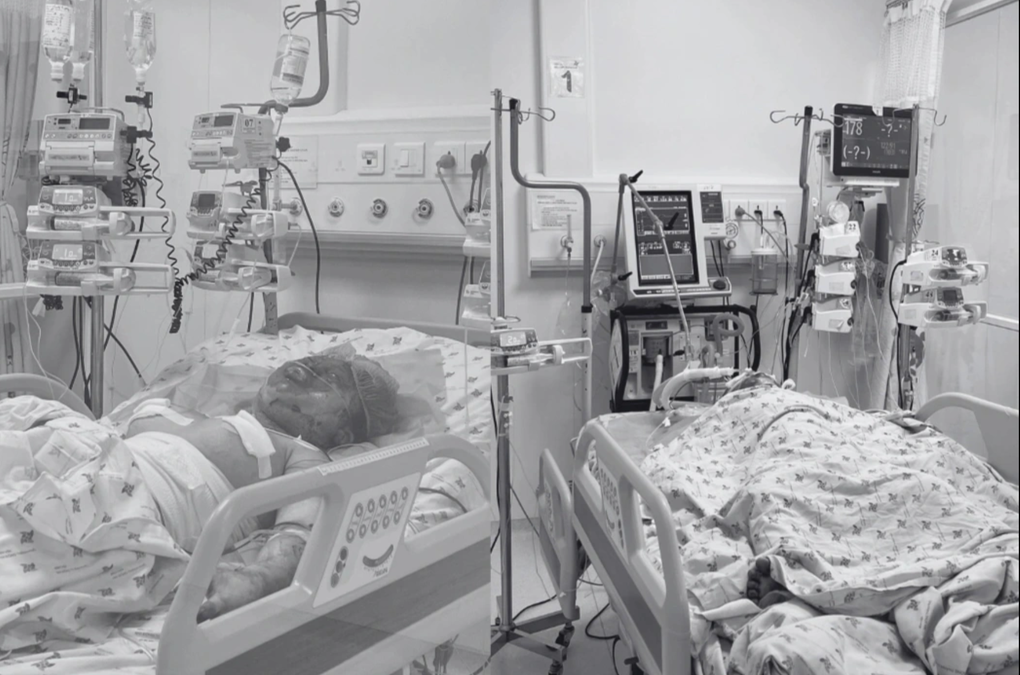 Bé trai 5 tuổi bị cha đốt xăng, bỏng 80% kiên cường vượt 96 ngày điều trị - 1