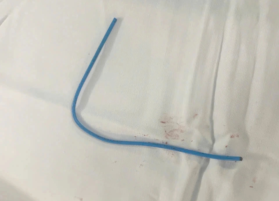 Bệnh viện Quân y 175 tiếp nhận ca bệnh dị vật kẹt trong tim hiếm gặp - Ảnh 1.