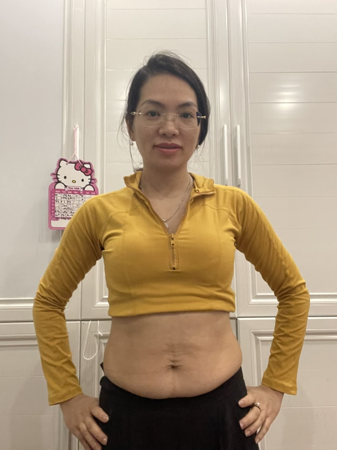 Sau khi sinh con thứ hai, cân nặng của chị Nhung không thay đổi nhiều nhưng vòng hai to, nhiều mỡ. Ảnh: Nhân vật cung cấp